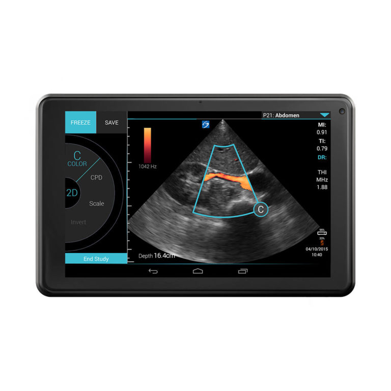 2D Sonosite Edge 2 Ultrasound System at ₹ 2200000 in Lucknow | ID